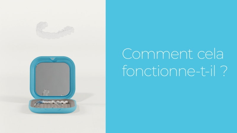 Orthodontie Béthune Vidéo de présentation des aligneurs pour adultes HD